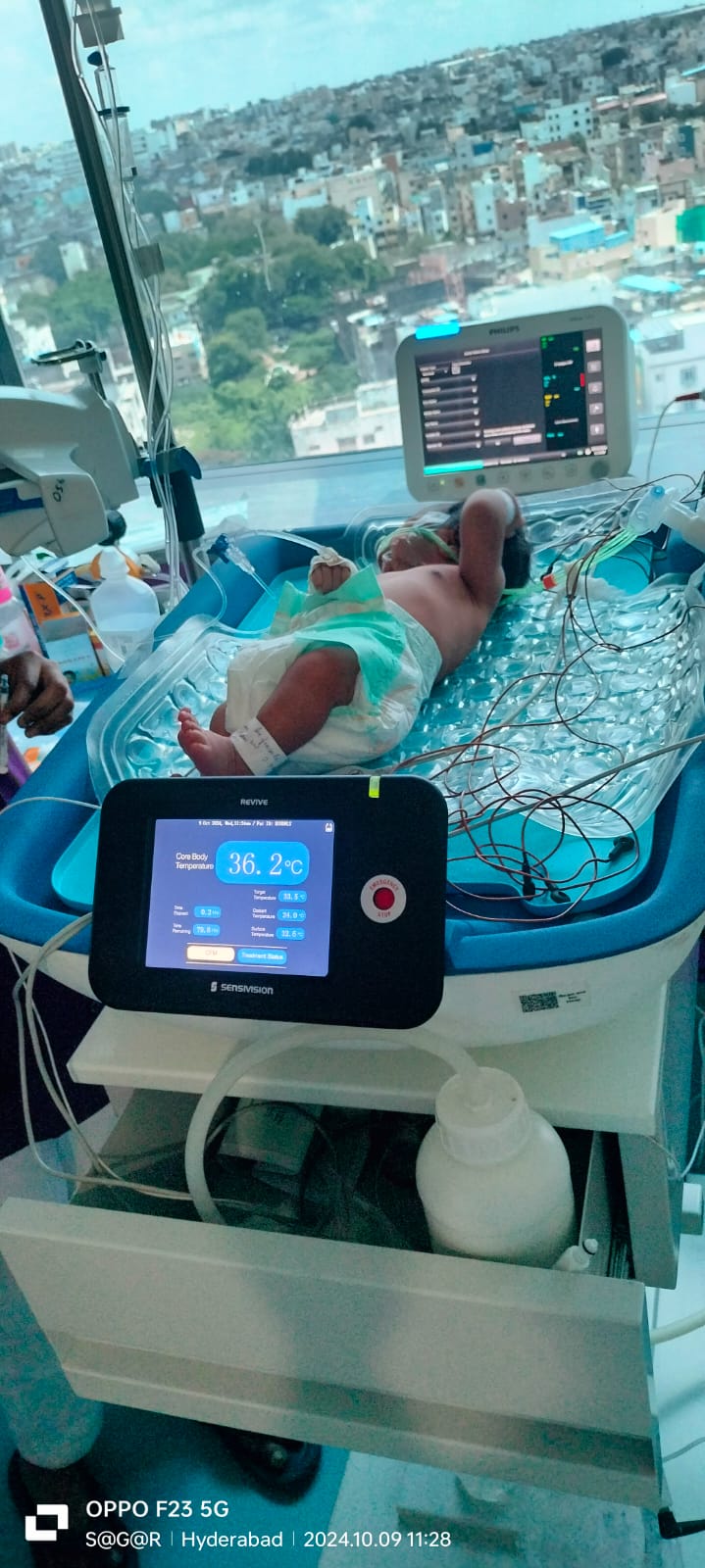REVIVE whole body cooling device by Sensivision Health Technologies Pvt. Ltd. in hospital NICU treating newborn with Hypoxic Ischemic Encephalopathy, showing touchscreen display with 36.2°C core body temperature monitoring and blue cooling mat